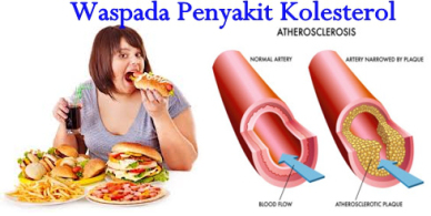 Awas Bahaya Kolesterol Tinggi, Tidak Perlu Lauk Daging Terus Tiap Makan